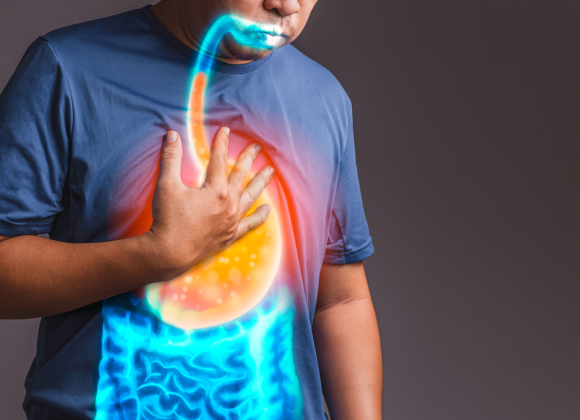 GERD Treatment Guide: Medications, Lifestyle Changes & Surgery GAS