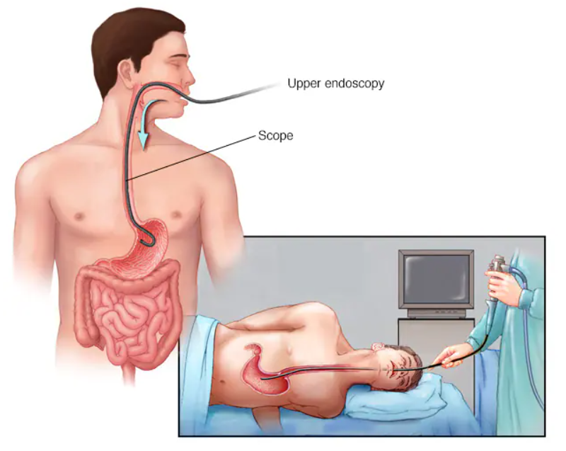 Endoscopy