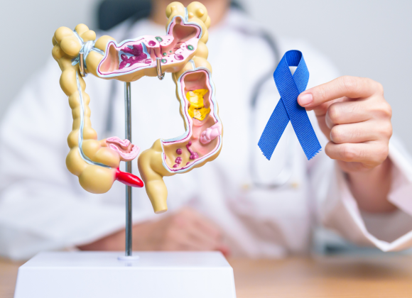 Understanding Colon Cancer: Early Signs, Risk Factors, and How to Prevent It kjndkj