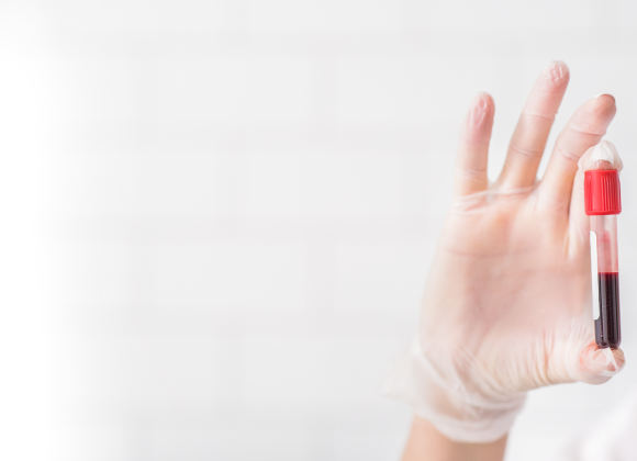 What Makes Bombay (hh) Blood Group So Unique? Bombay blood group