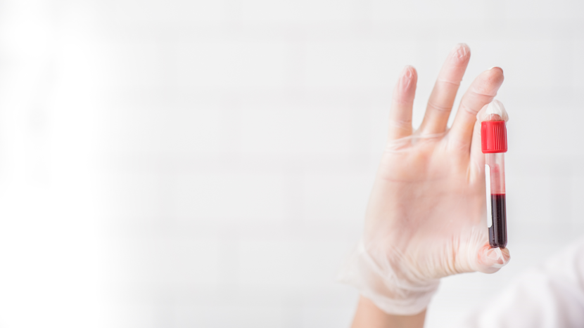 What Makes Bombay (hh) Blood Group So Unique? Bombay blood group