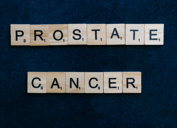 Prostate Cancer: Causes, Risk Factors, and Prevention Tips Prostate Cancer