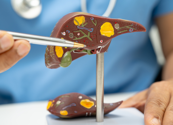 Liver Cirrhosis: 6 Early Signs Your Liver Is in Trouble kkjnon