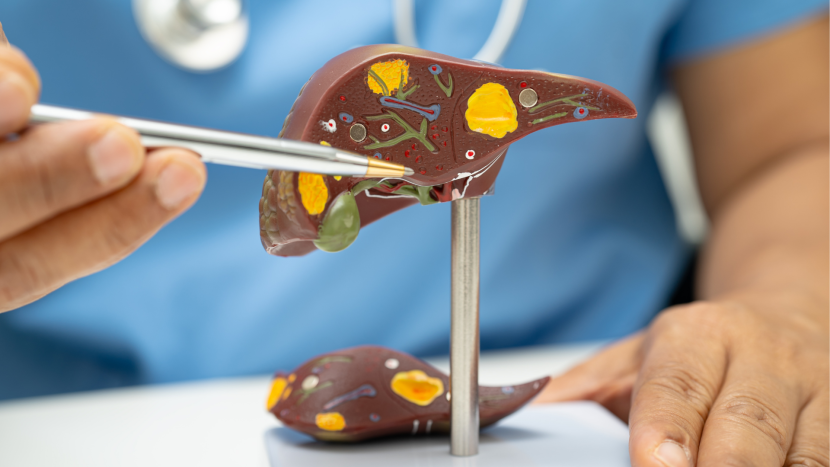 Liver Cirrhosis: 6 Early Signs Your Liver Is in Trouble kkjnon